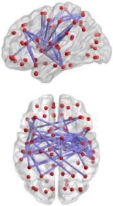 A lateral view of the human brain highlighting the frontoparietal control network in orange and yellow across the frontal and parietal lobes.